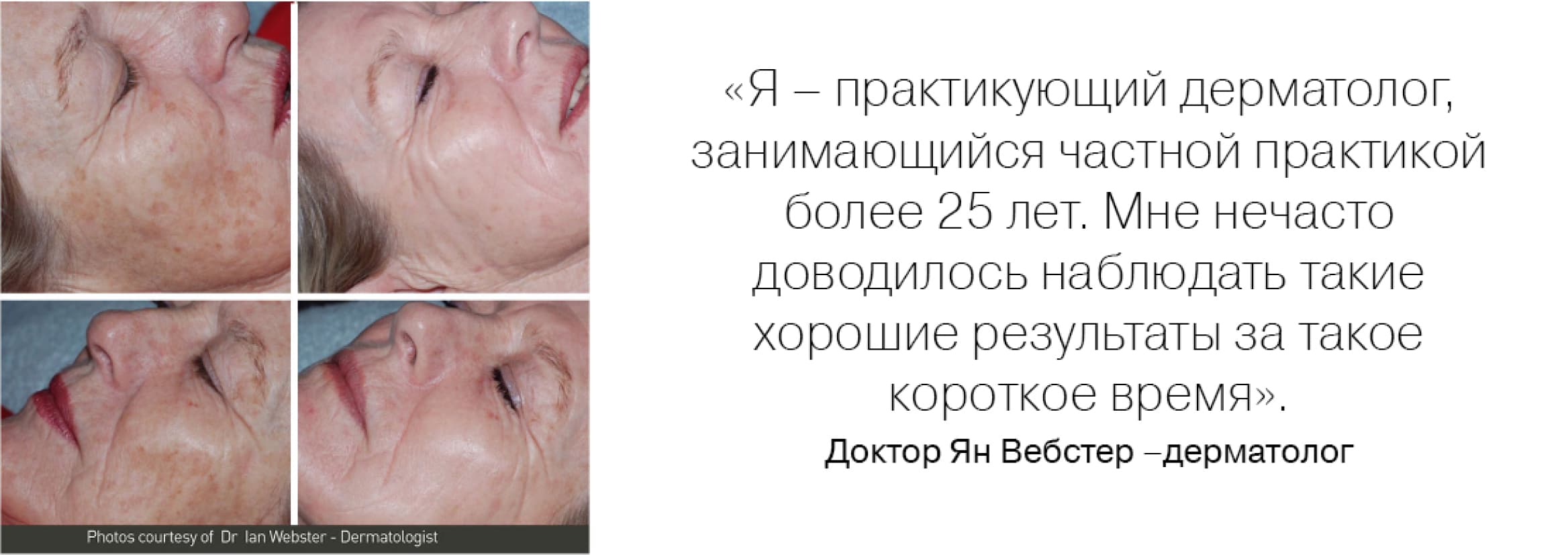 «Я — практикующий дерматолог, занимающийся частной практикой более 25 лет. Мне нечасто Доводилось наблюдать такие хорошие результаты за такое короткое время». Доктор Ян Вебстер — дерматолог